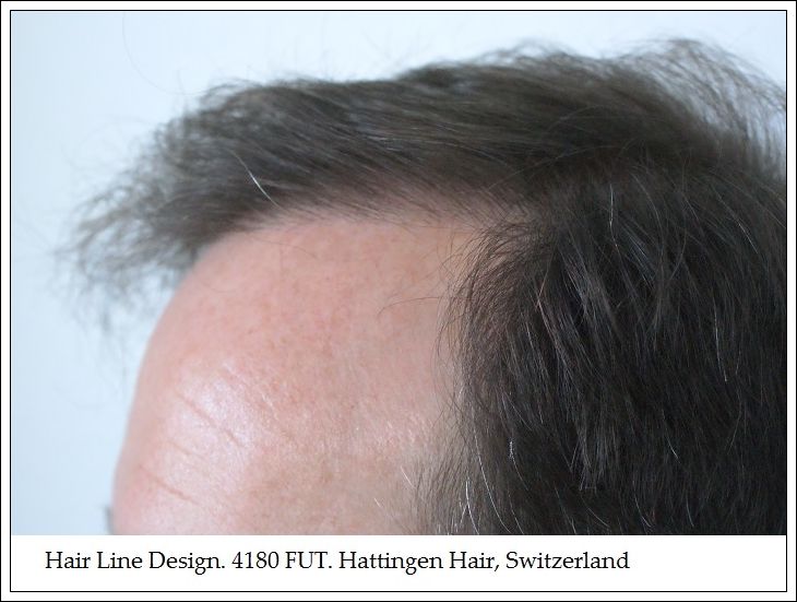 HairLineDesign4180FUTHattingenHairSwitzerland_zps87ce5b84.jpg
